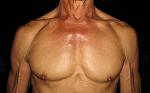 This is a close up photograph of my chest as I breathe in.